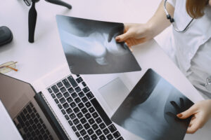 Is Arthritis Recognized as a Disability