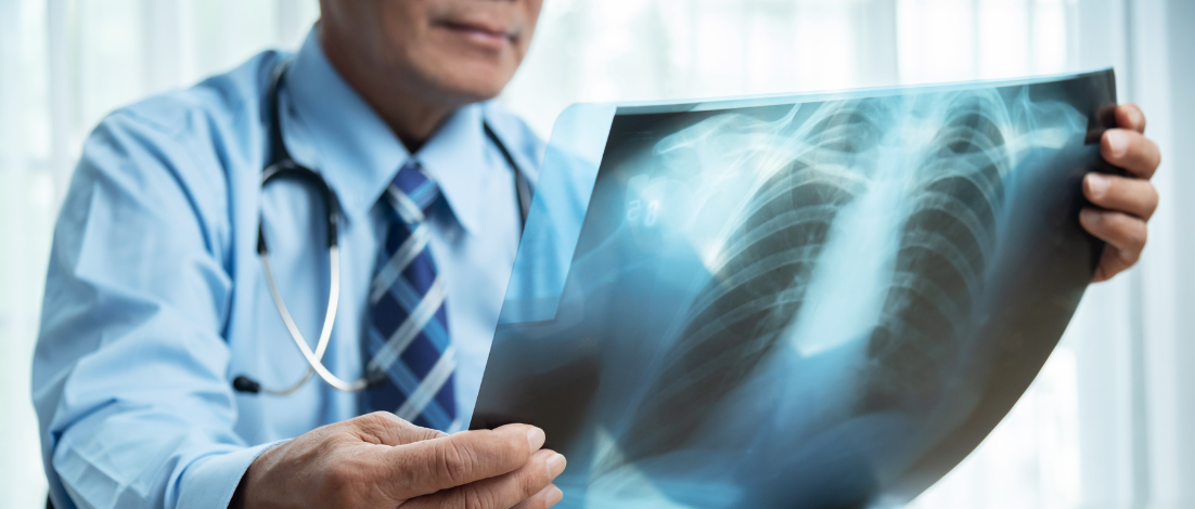 COPD and Social Security Disability